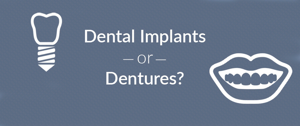 Dental Implants or Dentures?