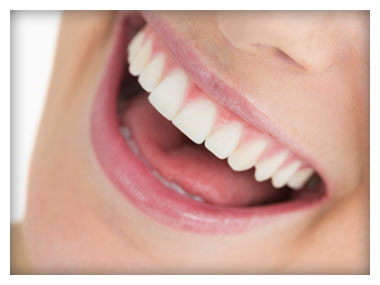 Smiling with Porcelain Veneers Smiling with Porcelain Veneers