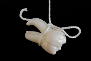 Tooth Extraction extracted tooth on a string