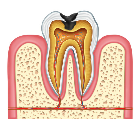 Root Canal Therapy Inner Anatomy of a Cavity