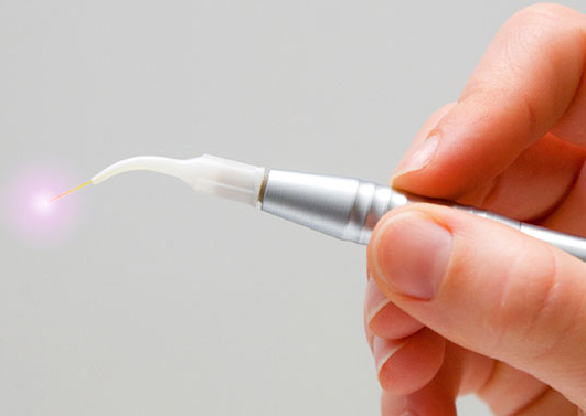 Dental Laser Pick Dental Laser Pick