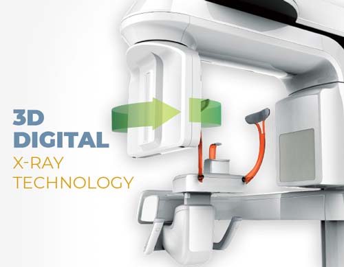 3D Digital X-Ray Technology