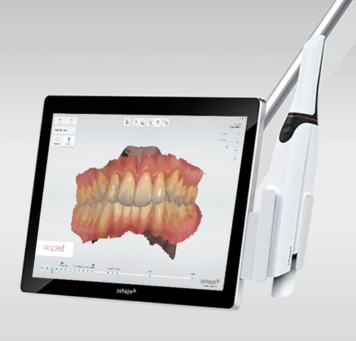 3 Shape Trios Intraoral Scanner