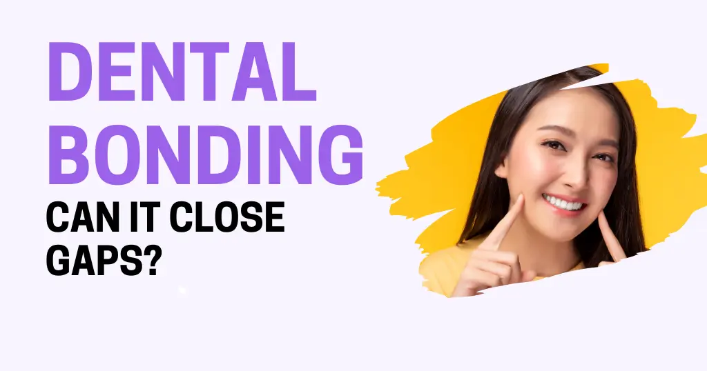 Dental Bonding Blog Header